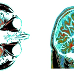 What If We Had Bigger Brains?